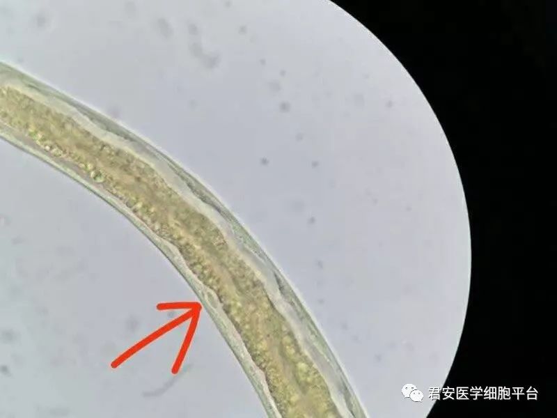 钩虫在显微镜下的图片图片