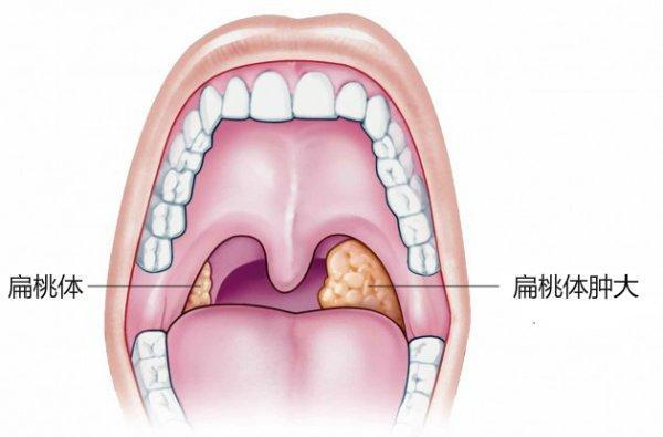 立毛肌切片图片