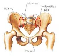 女性朋友们常有的困扰骶髂关节疼痛