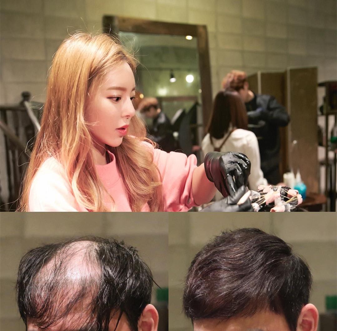 韩国网红发型师专为头发稀少的男士设计发型