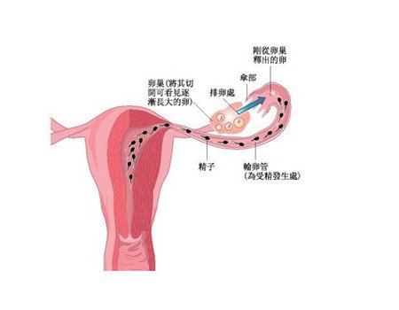 输卵管性不孕原因有很多 慎重选择检查方式和时机