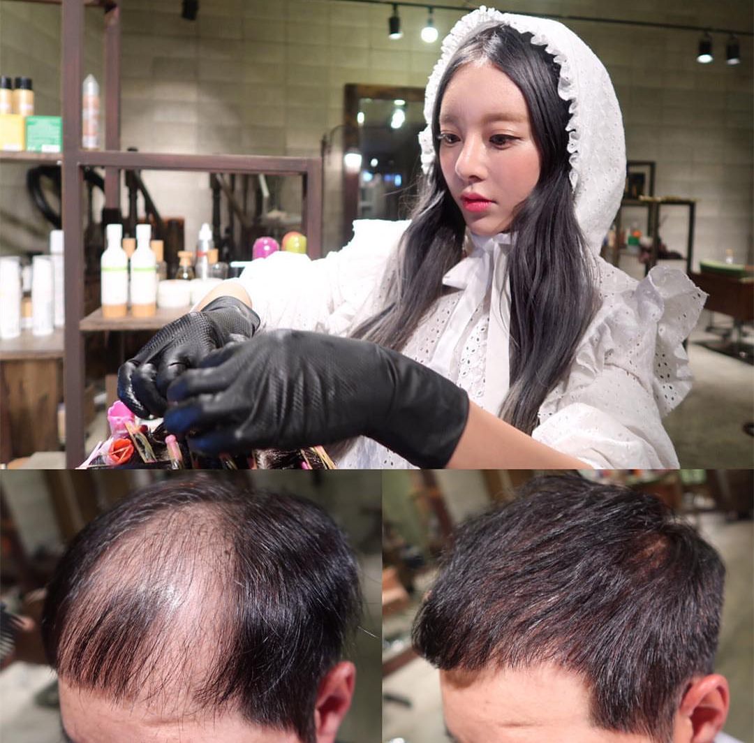 韩国网红发型师专为头发稀少的男士设计发型