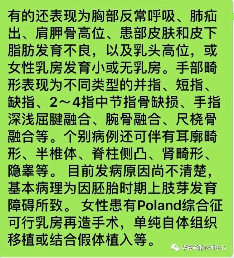 波兰综合症孩子寿命图片