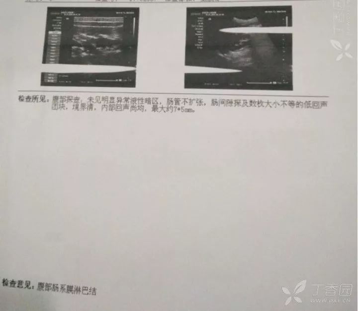 肠系膜淋巴结严重吗图片