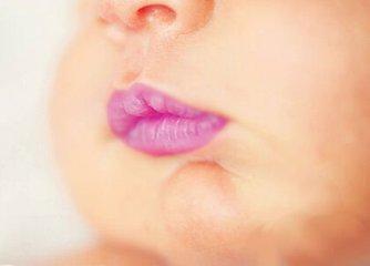 新生儿嘴唇发紫图片