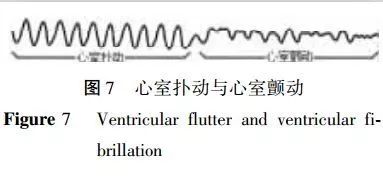 心基层室颤vs房颤急救各不同