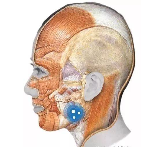 肉毒素注射位置太浅肉毒素需要注射到咬肌内才能达到效果,如果不小心
