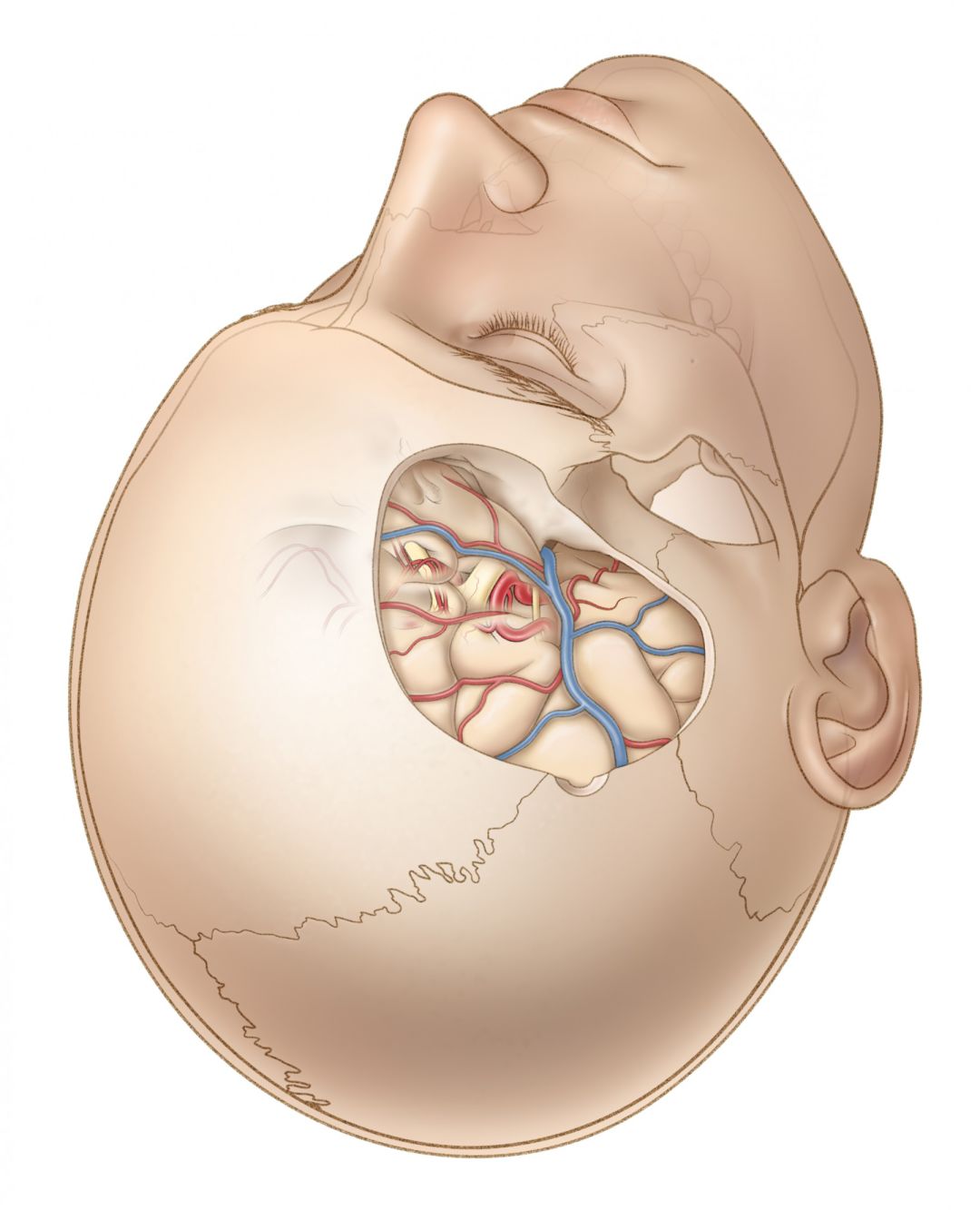 開顱手術入路總體原則 | the neurosurgical atlas全文翻譯