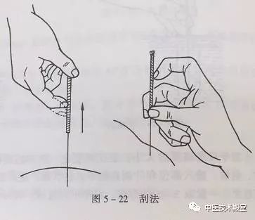 球后针刺手法示意图图片