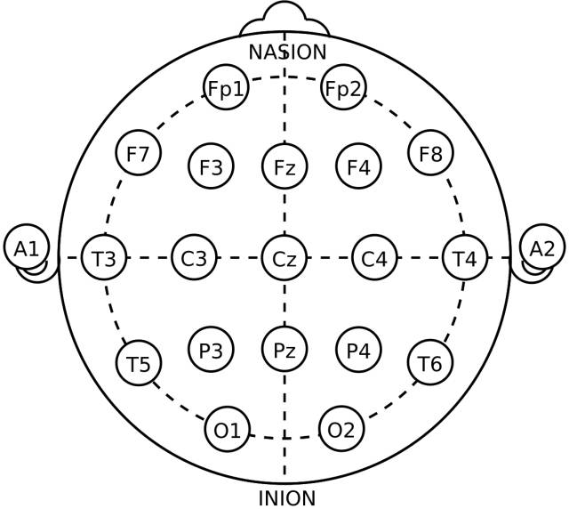 脑电图电极位置及名称图片