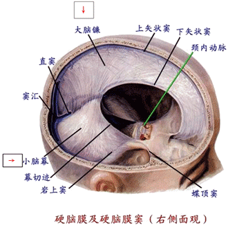 脑疝分类5,先天因素,如小脑扁桃体下疝畸形