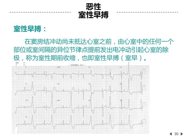 围术期遭遇恶性心律失常,如何正确识别与处理?