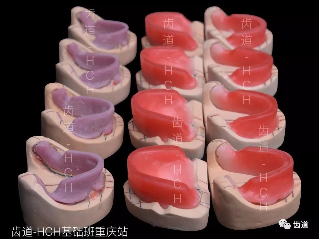 齒道-hch全口義齒線下實操班學習用模型欣賞:初模,個託,終模,蠟堤