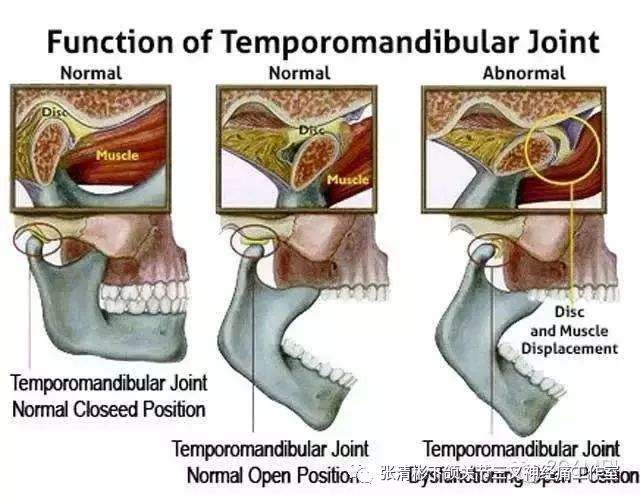 廣醫口腔顳下頜關節紊亂病的特色診療模式—序列,微創,舒適化