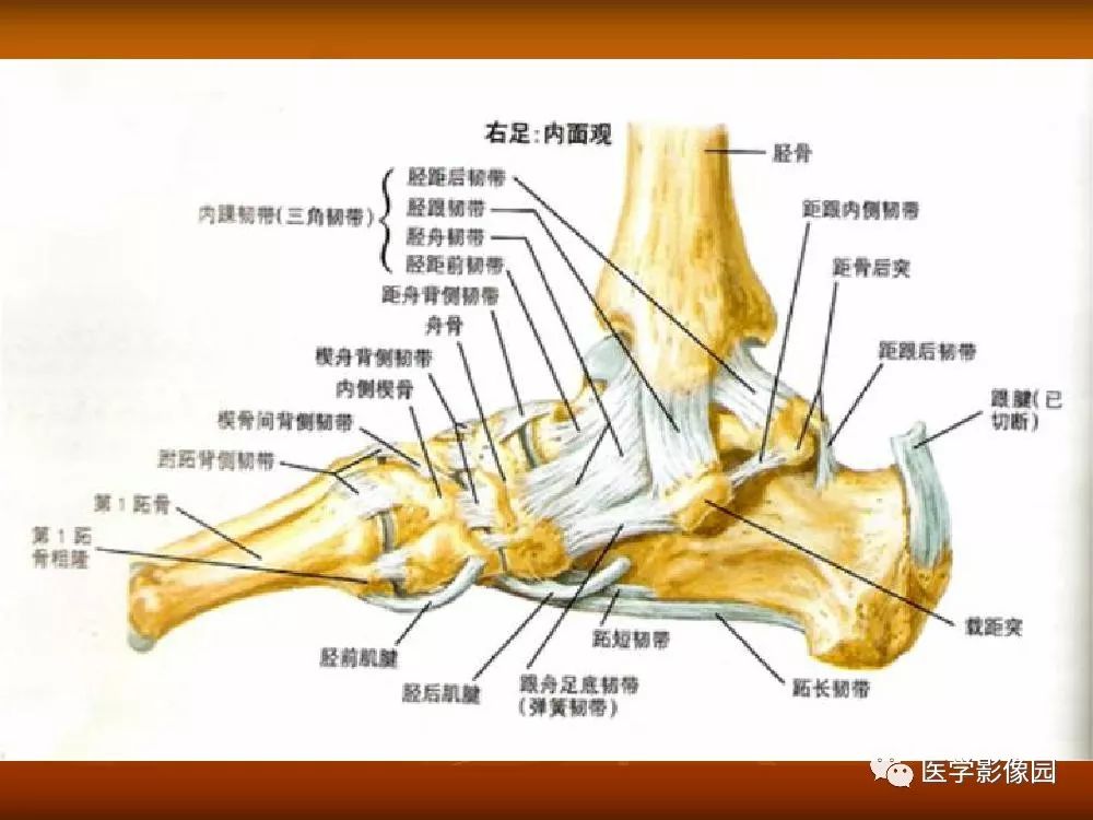 跗跖关节韧带解剖图片