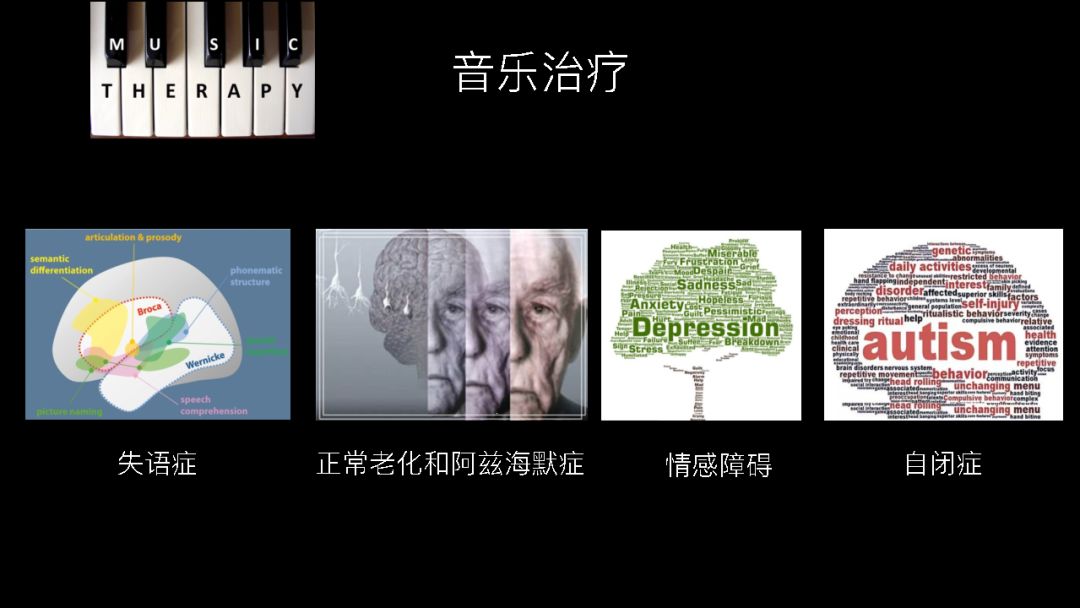 除了治療失語症,音樂治療還被用於治療阿爾茲海默氏症.