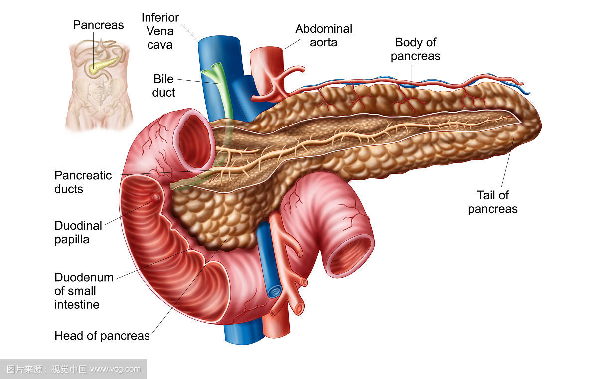 主胰管图片