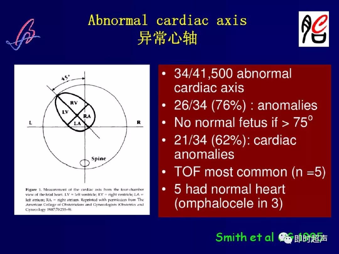 胎儿心脏的正常和异常超声解剖