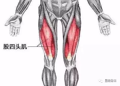 股四头肌的位置:大腿前侧股四头肌力量训练对于下肢功能有着极为重要