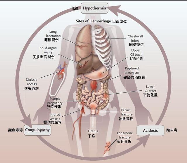 休克早期图片