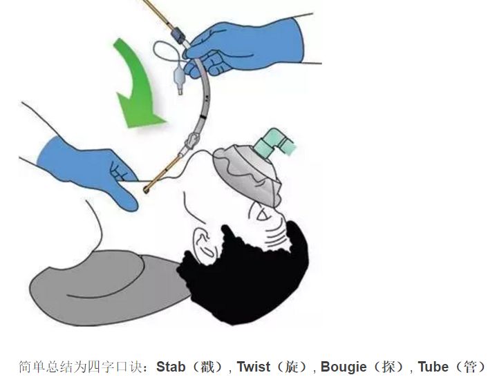 無法氧合 對高危腹腔手術患者採用阿普加外科手術評分的預後 術後