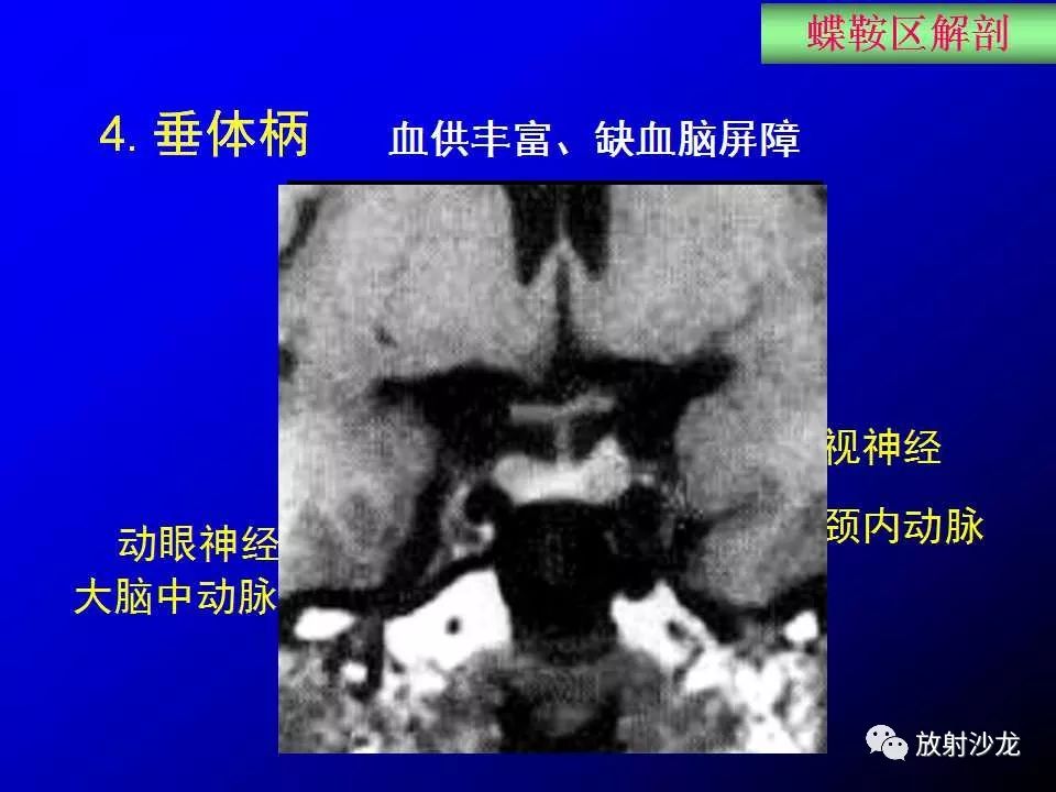 蝶鞍區解剖及疾病的影像解剖