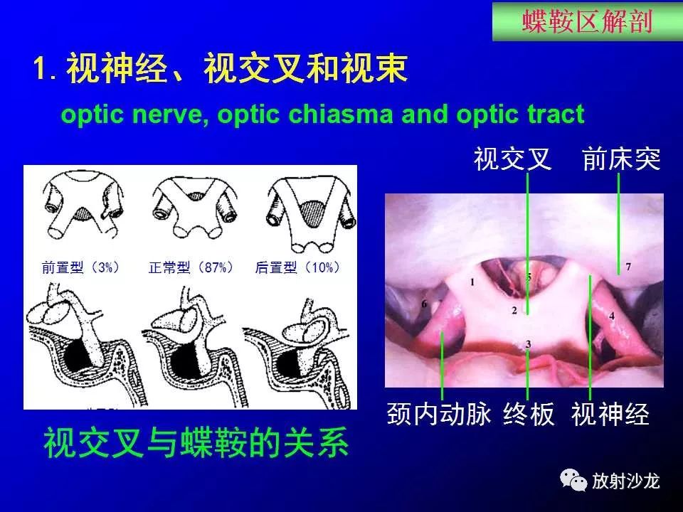 蝶鞍區解剖及疾病的影像解剖