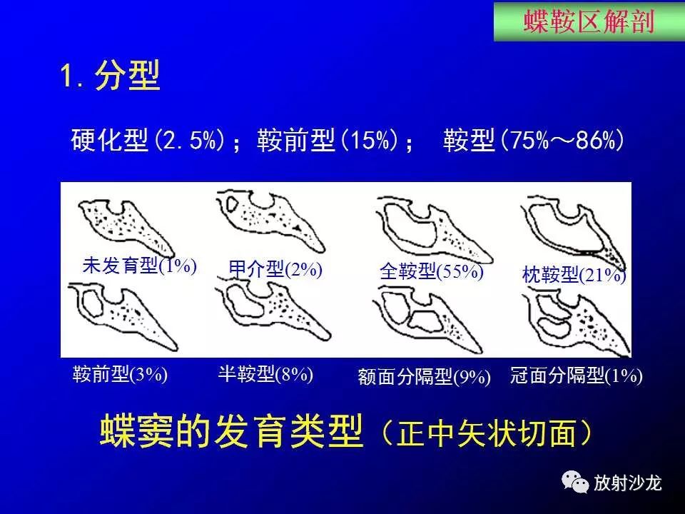 蝶鞍床突解剖图片