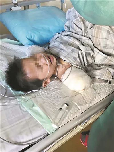 广东:遭万伏高压电伤,5岁男童双臂被截肢!原因令人后怕