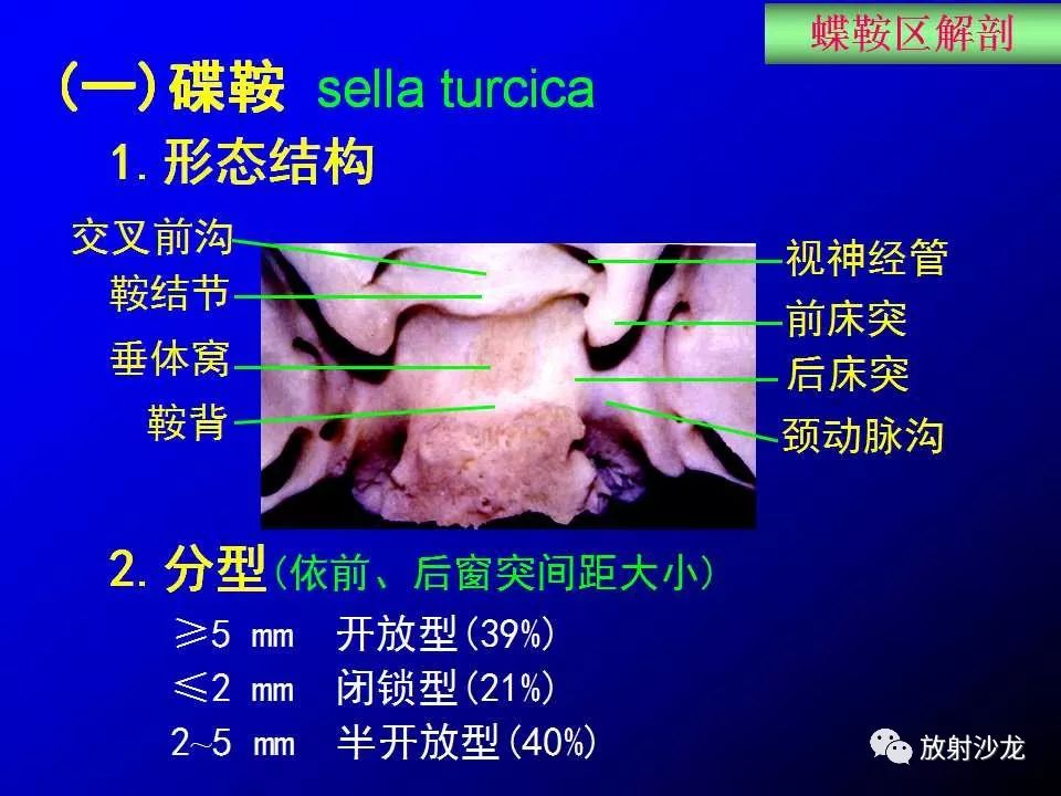 蝶鞍區解剖及疾病的影像解剖