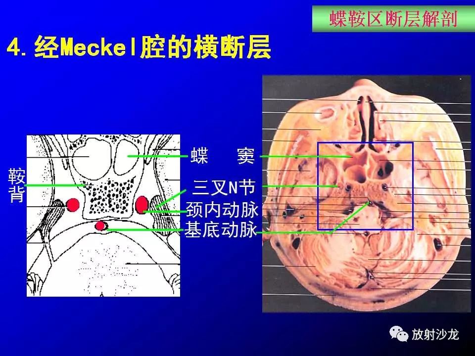 蝶鞍中心图片