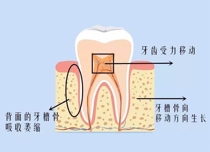 此时正是乳牙全部被更换,恒牙生长的初期,牙齿移动,恢复到正常位置较