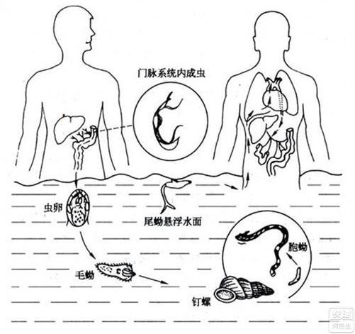 把血吸蟲寄生到17人體內這感染科醫生膽子真大