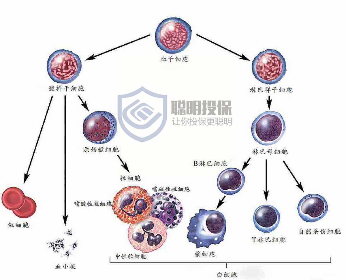 白血病 细胞分化图片