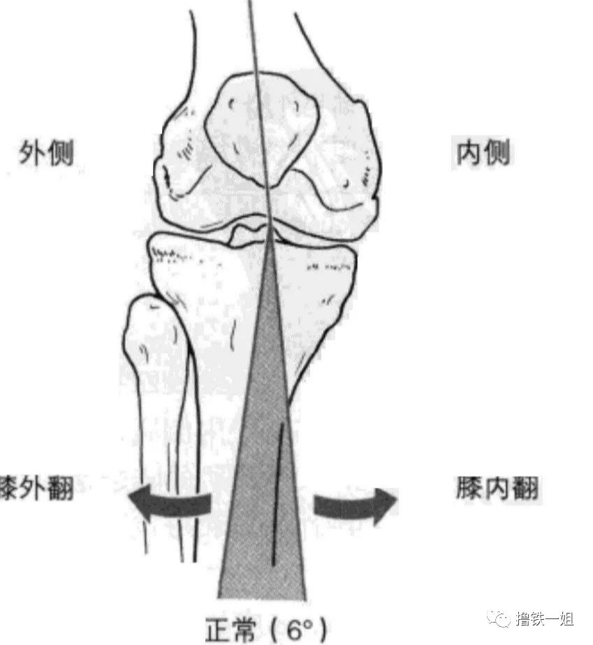 膝关节外翻测量图示图片