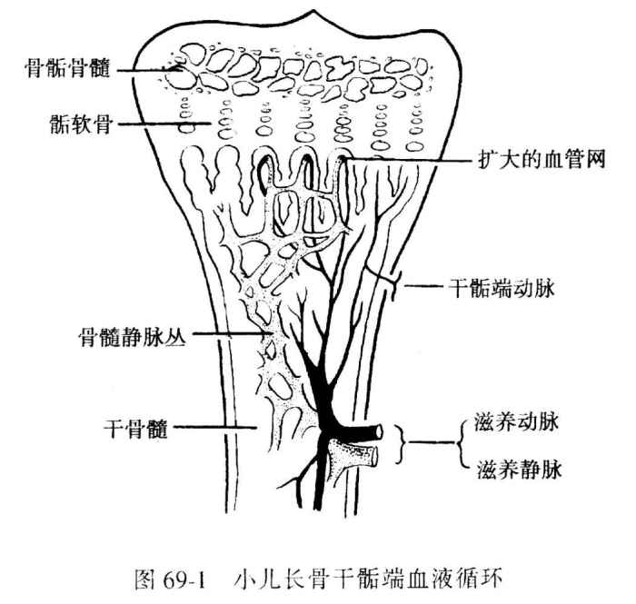 骨結核又復發了,原因是什麼!