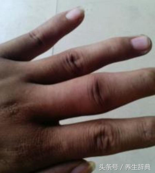 世界上手指最硬的人图片