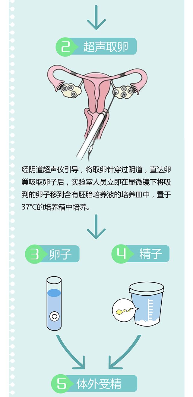 试管婴儿国家报销流程是什么样的(2019试管婴儿费用纳入医保报销)-第1张图片-鲸幼网