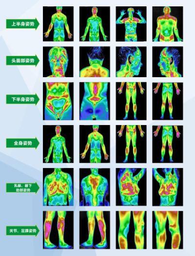 tmt红外线热成像扫描,一眼看穿你的健康状况!