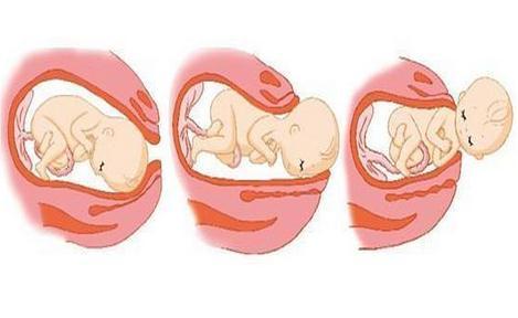 胎儿入盆过程图图片