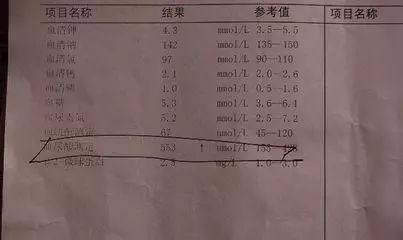 尿酸从780降到300医生表示做到这3方面远离高尿酸