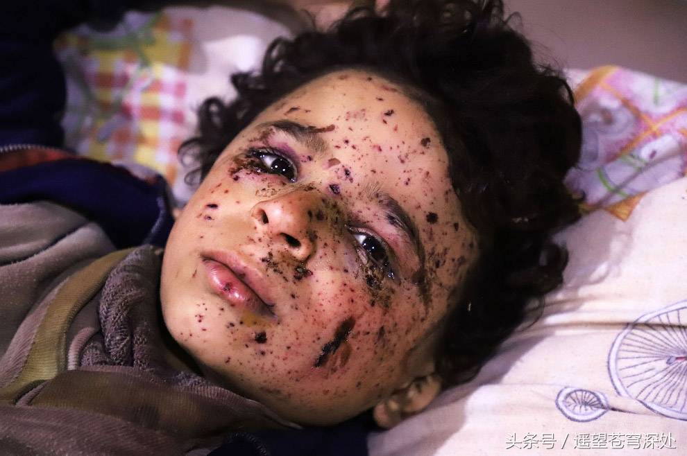叙利亚战场图片 女尸图片
