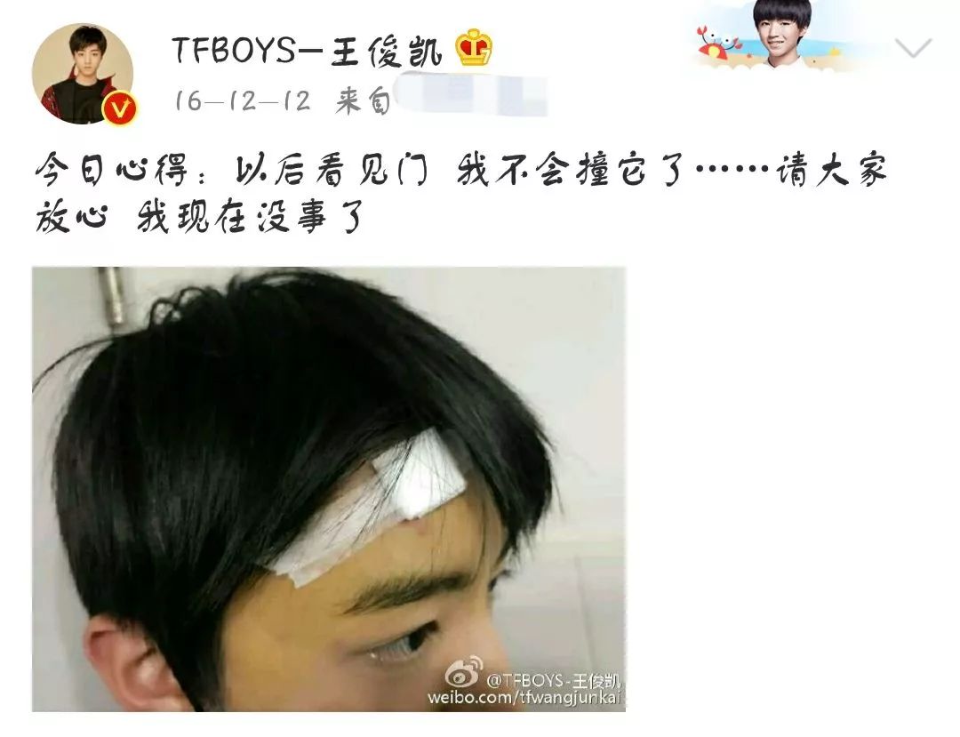 王俊凯也是受过伤的男人,目前他的身上已经留下两处疤痕