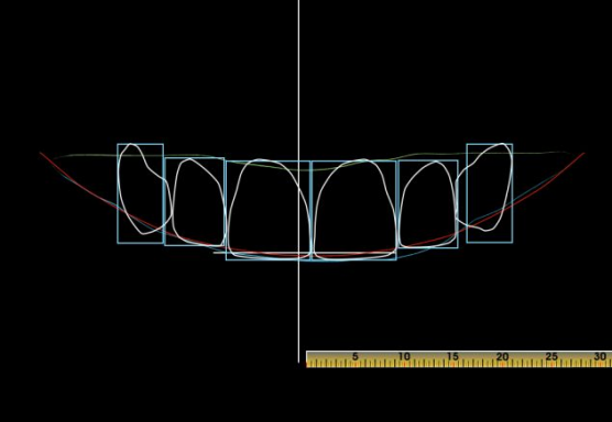 dsd数字微笑设计图片