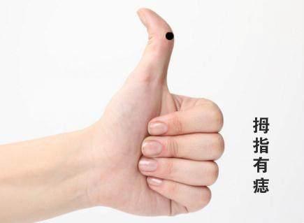 手指长痣的命运:每个指头代表什么,你知道吗?