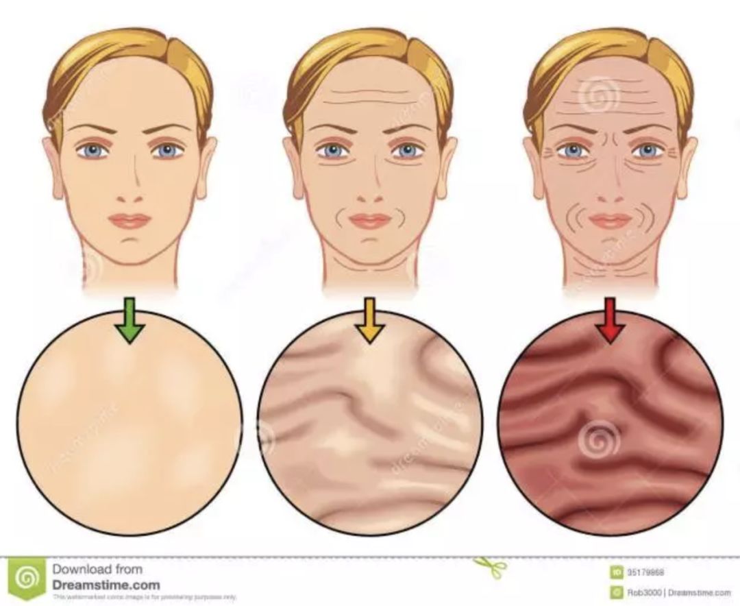 皱纹种类图片