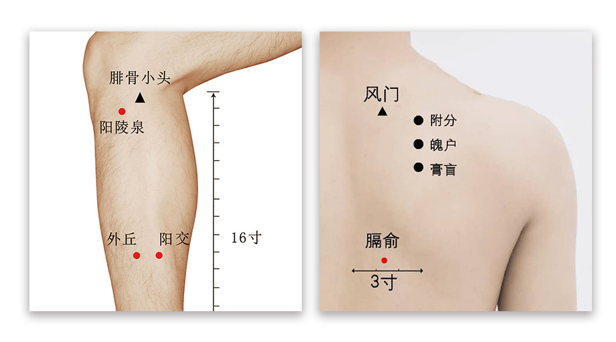 肝硬化艾灸治疗配穴附穴位图