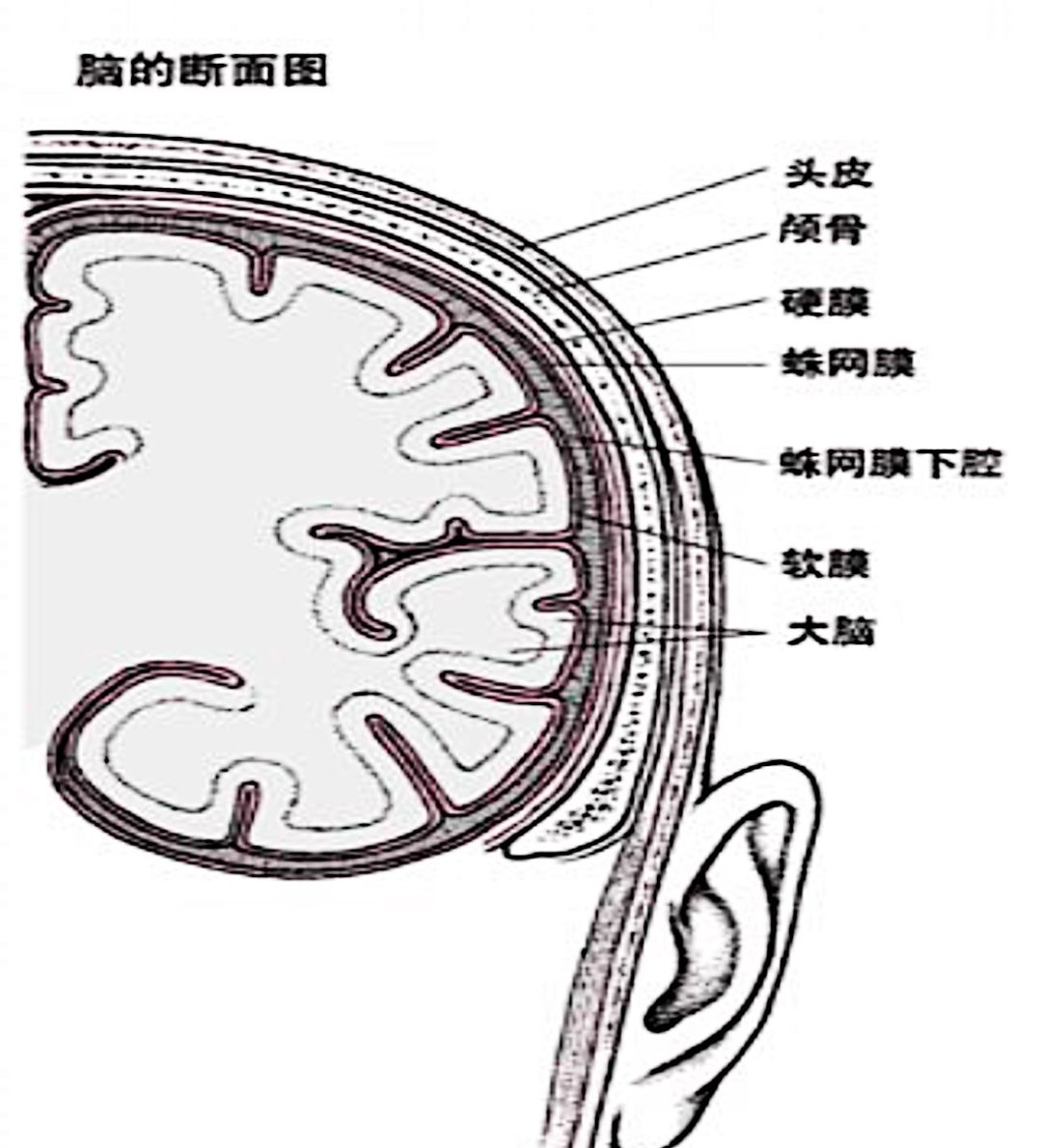 额颞蛛网膜下腔图片