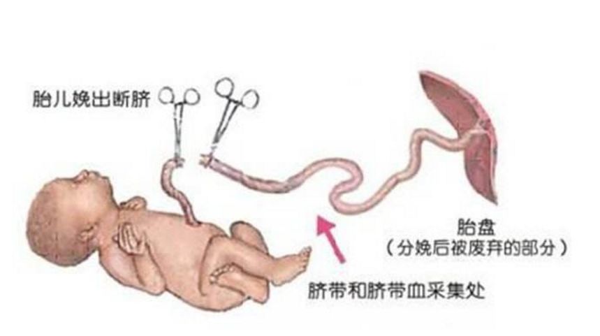 跟男友分手后却发现意外怀孕女子瞒着家人在厕所分娩结果割脐带时失手