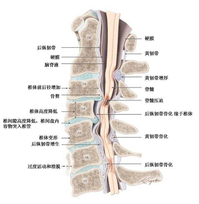 劲椎结构图图片